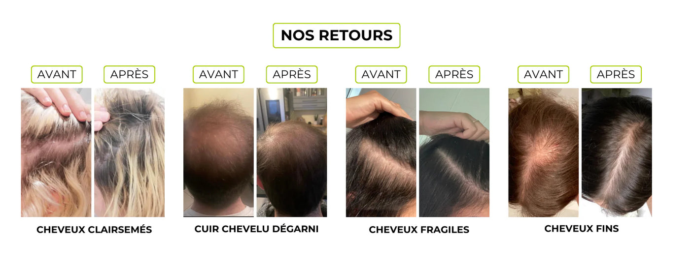 Hair growth serum - Scalp Boost 30 ml