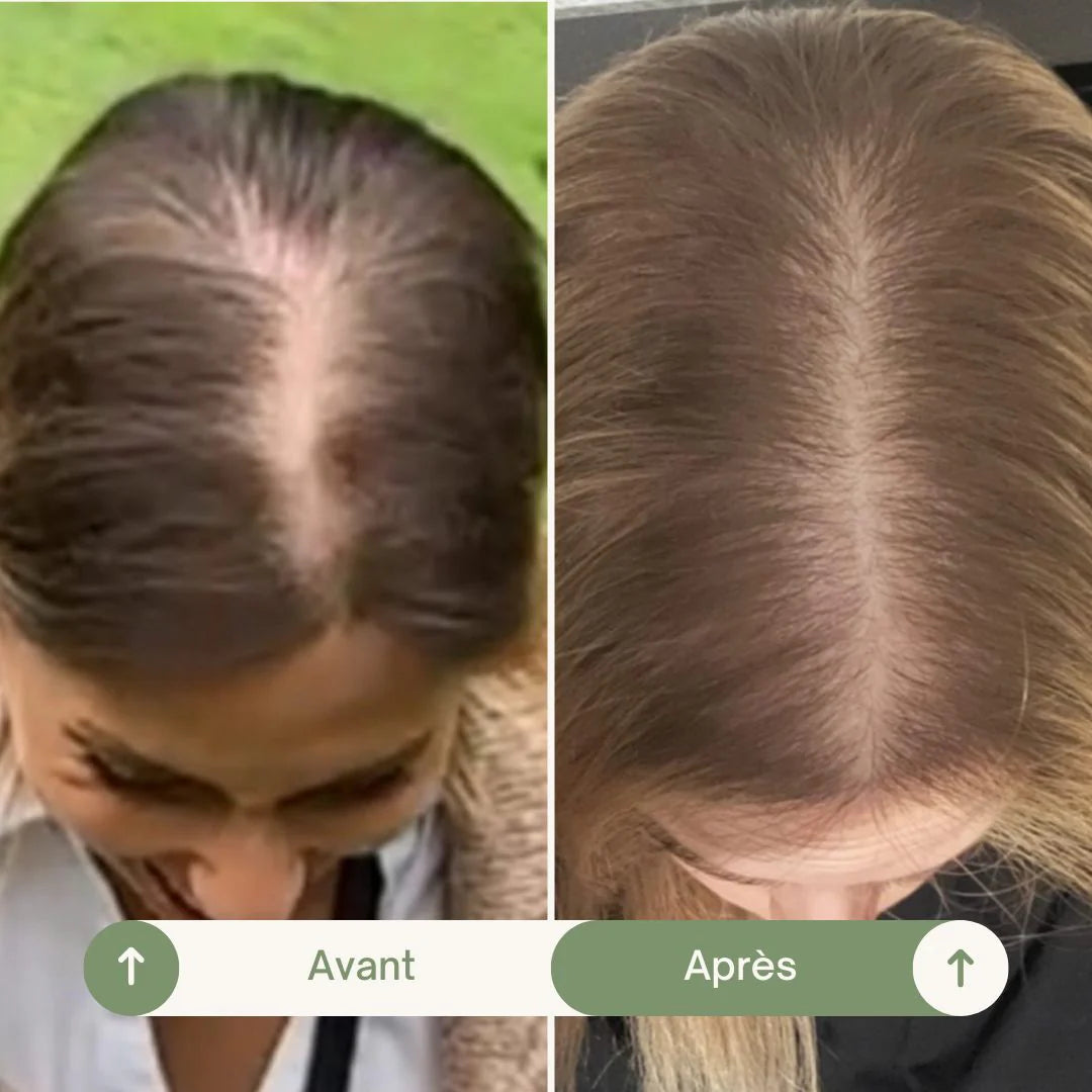 Accelerator Oil: Hair Growth Oil 100 ML