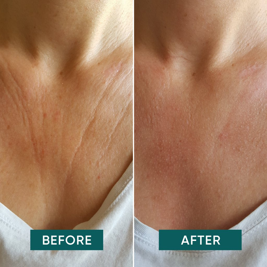 Decolleté Pad Vitamin C “décolleté delight” - 30 Treatments