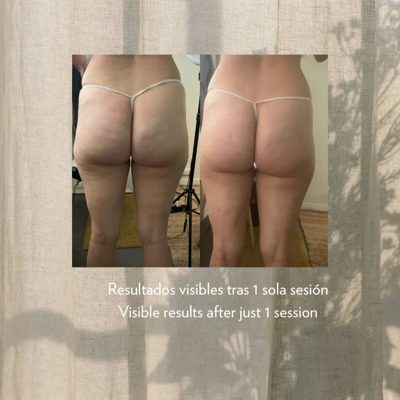 Silhouette Anti-Cellulite Slimming Serum 200 ml