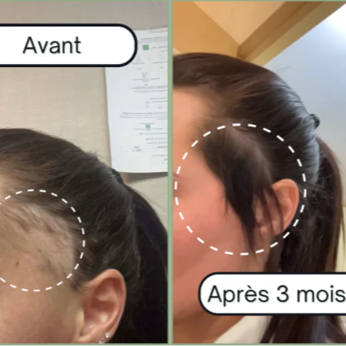 Hair Nutrition Supplement 90 capsules