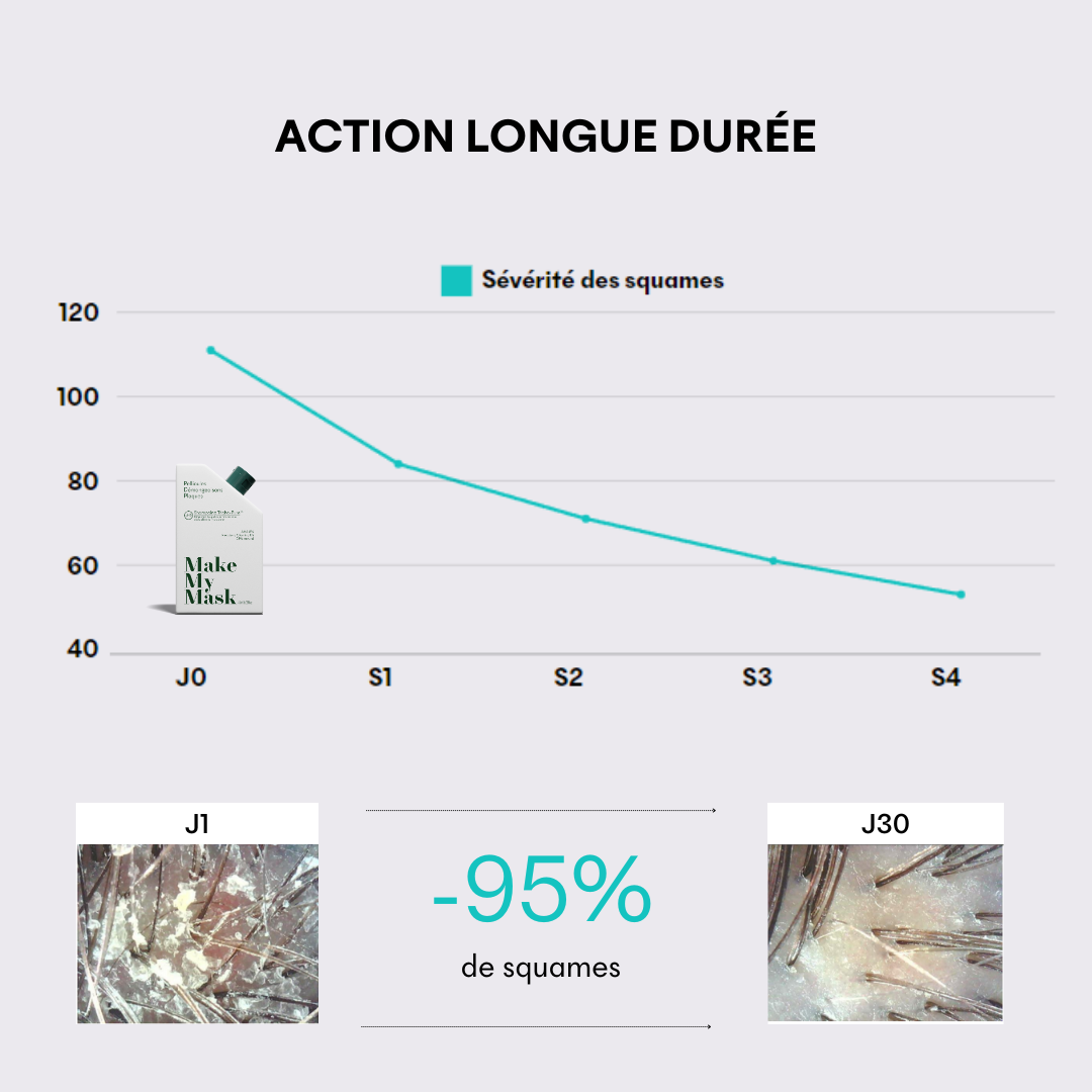 Tricho-Pure Anti-Dandruff and Itch Shampoo