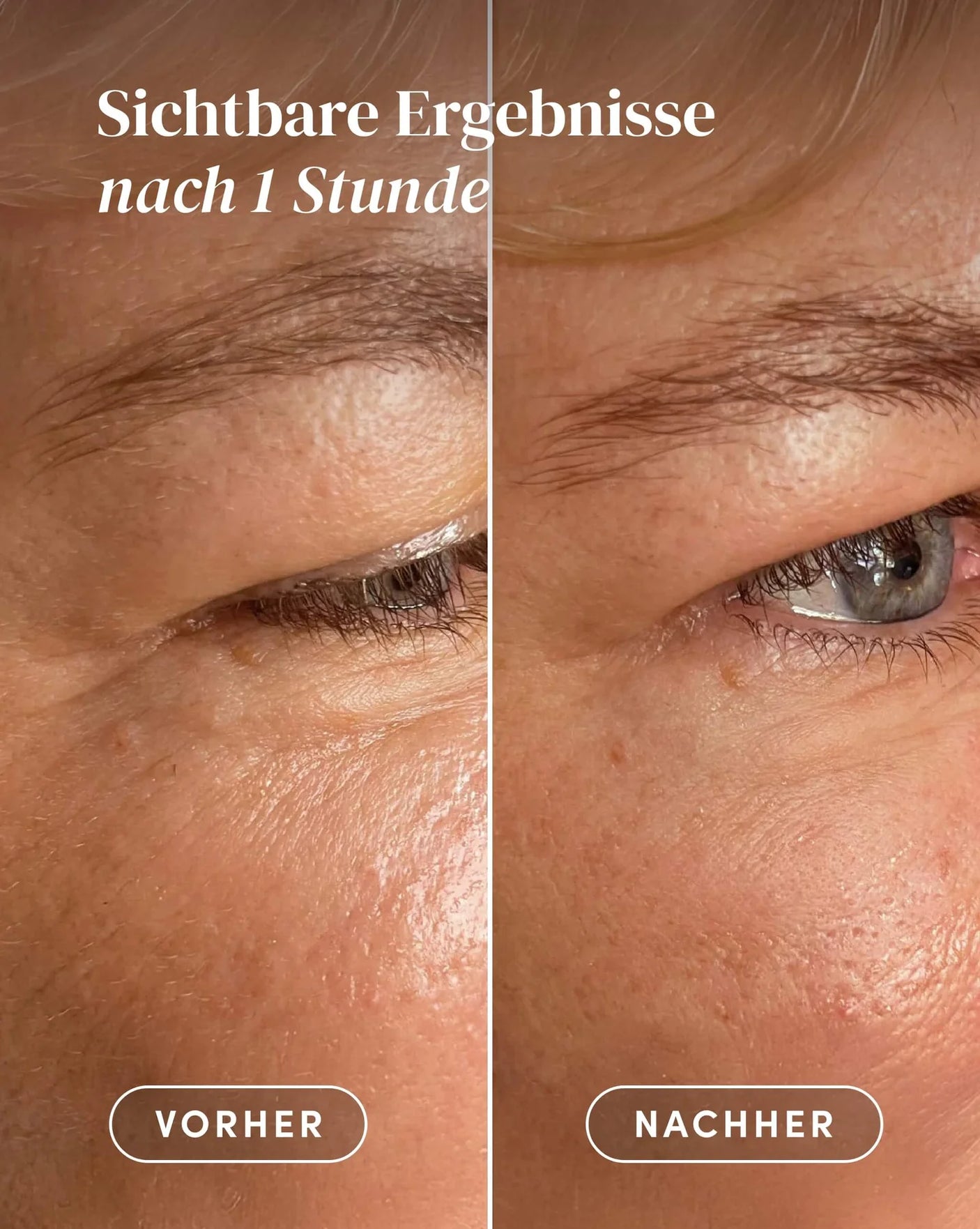 Pads reutilizables calmantes para ojos y sienes ideales para piel sensible