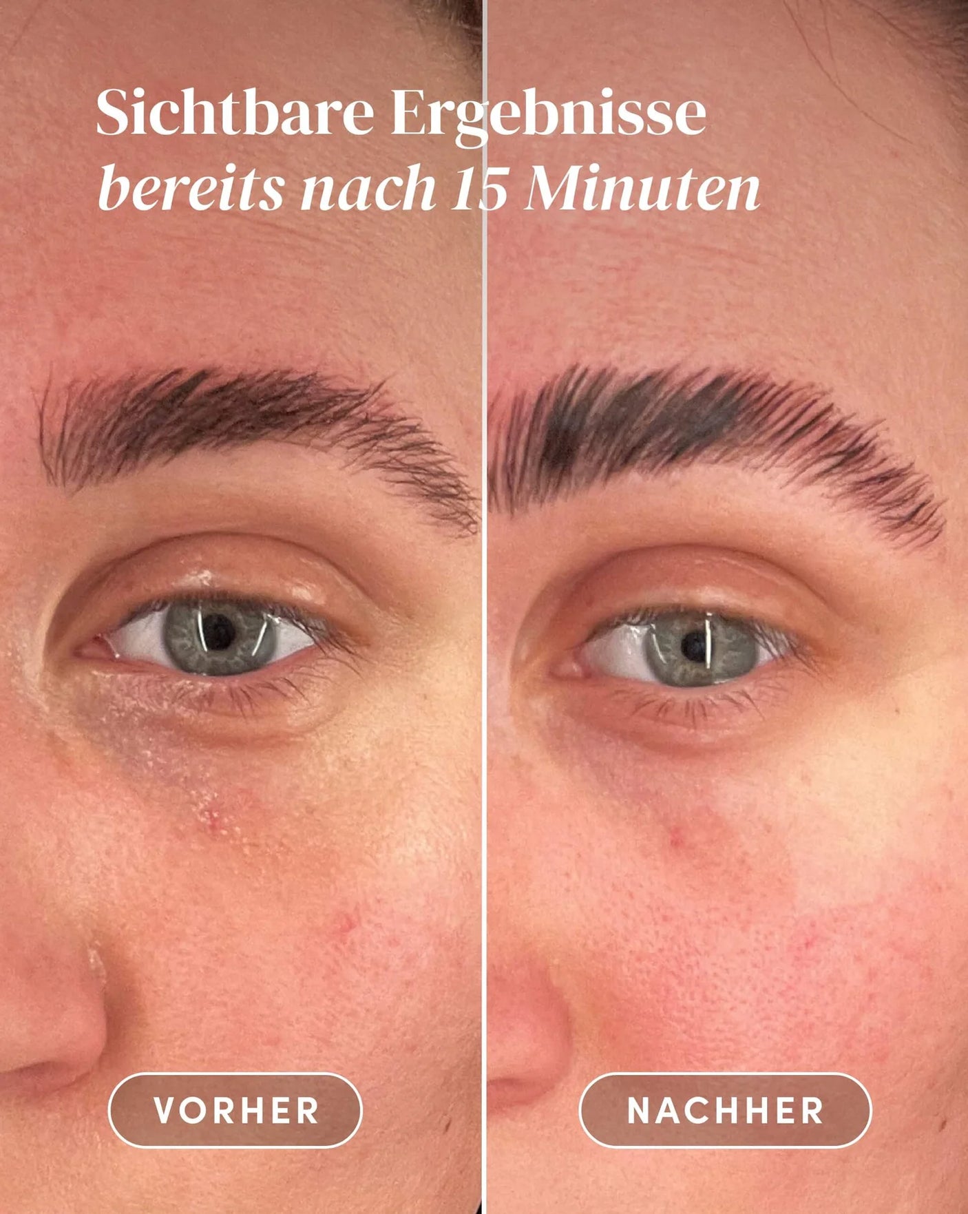 Pads antiedad reutilizables para ojeras y contorno de ojos - iluminan y suavizan líneas