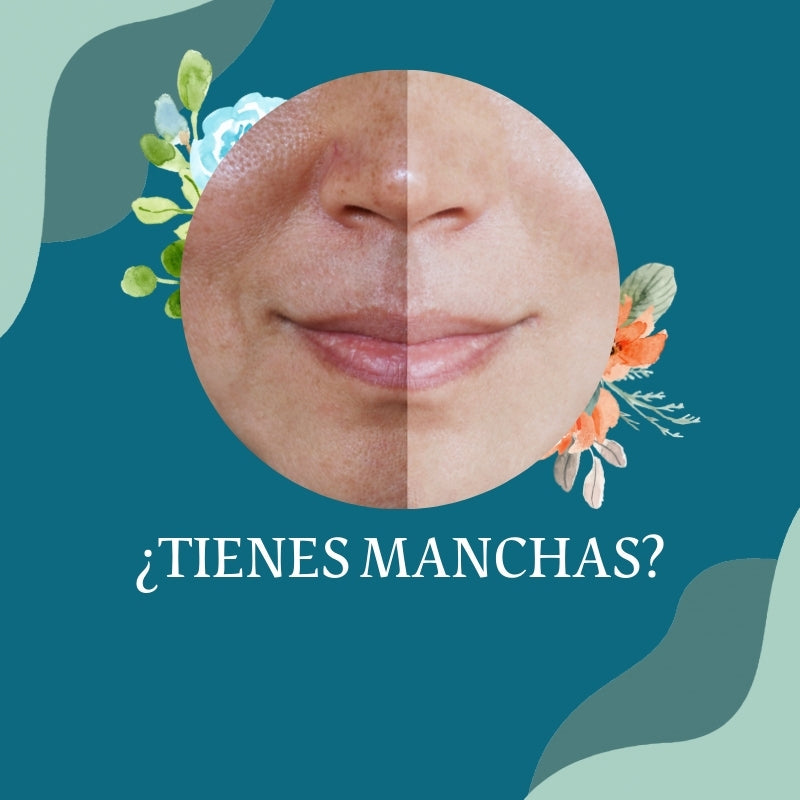 ¿Tienes manchas en la piel?