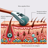 Tricho-Boost 0.5mm Hair Dermaroller