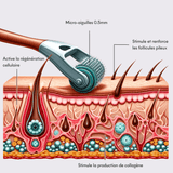 Dermaroller Capilar Tricho-Boost de 0,5 mm