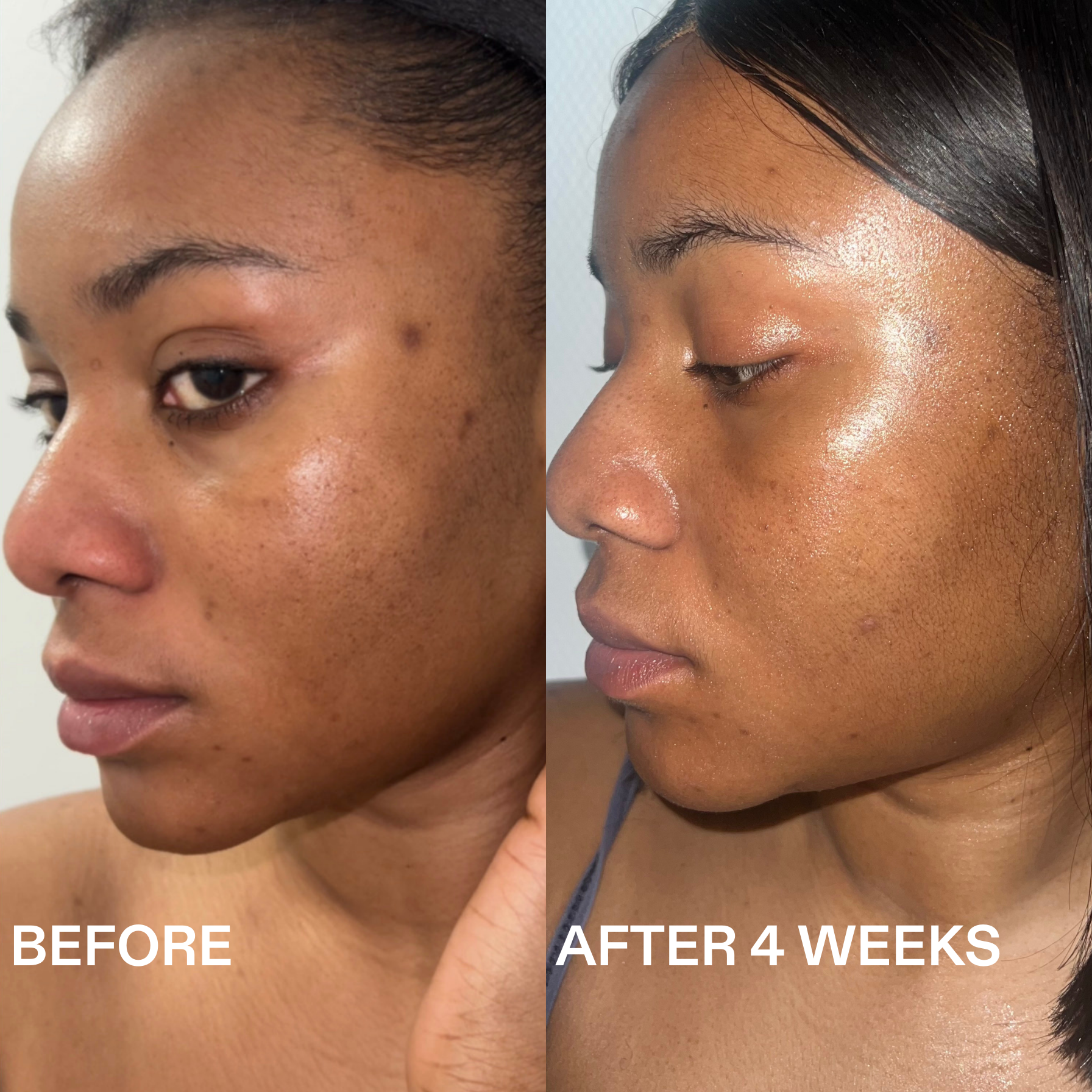 Sérum de Ácido Tranexámico Routinely – Tonificante y Antimanchas Nocturno