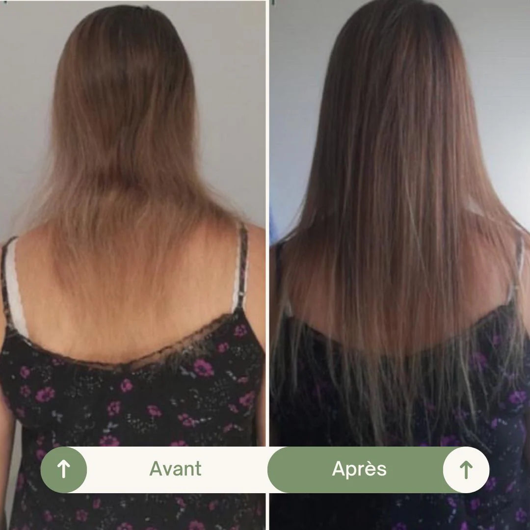 Aceite acelerador: Aceite para el crecimiento del cabello 100 ML