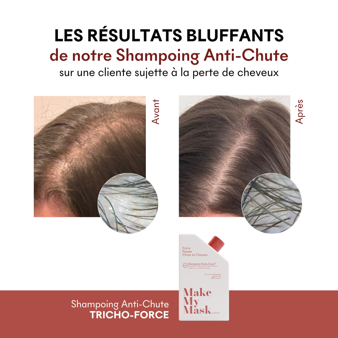 Champú Anticaída Tricho-Force pH5. 200 ml