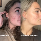 360° Azelaic Acid Serum Routinely – Even and radiant skin