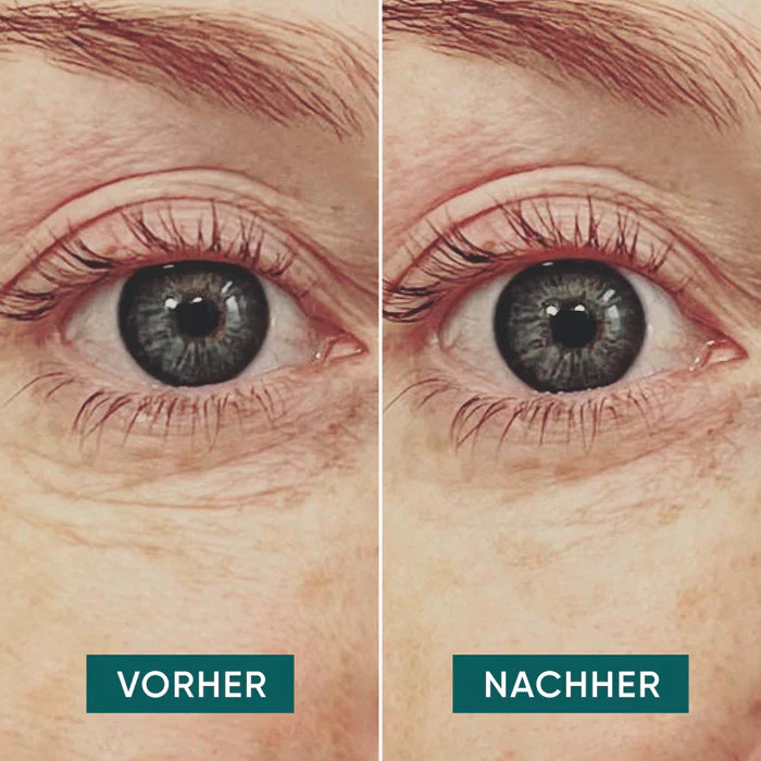 Reusable eye patches Me myself and eye with hyaluronic acid 2 reusable patches