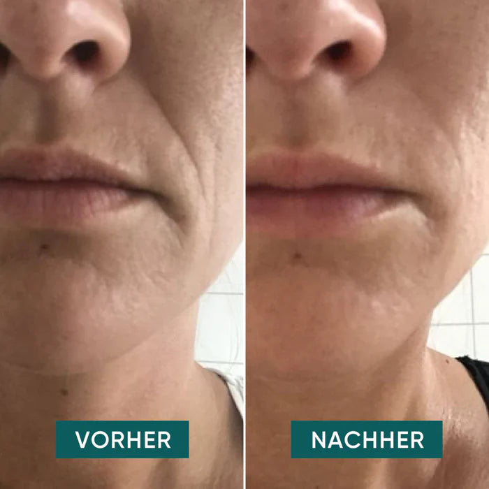 Reusable Patches Moisturized Lips I love your smile 2 reusable patches