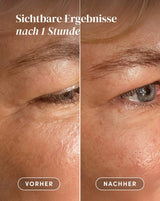 Pads reutilizables calmantes para ojos y sienes ideales para piel sensible