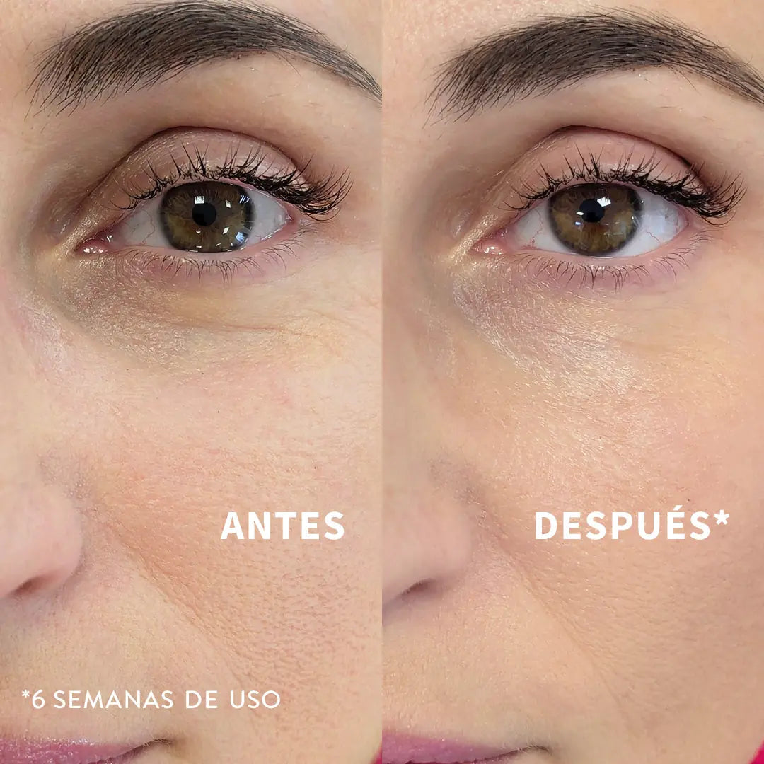 Resultado antes y después del Sérum Bakuchiol Antiedad - 6 semanas de uso | Biovardi Cosmética