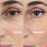 Resultado antes y después del Sérum Bakuchiol Antiedad - 6 semanas de uso | Biovardi Cosmética