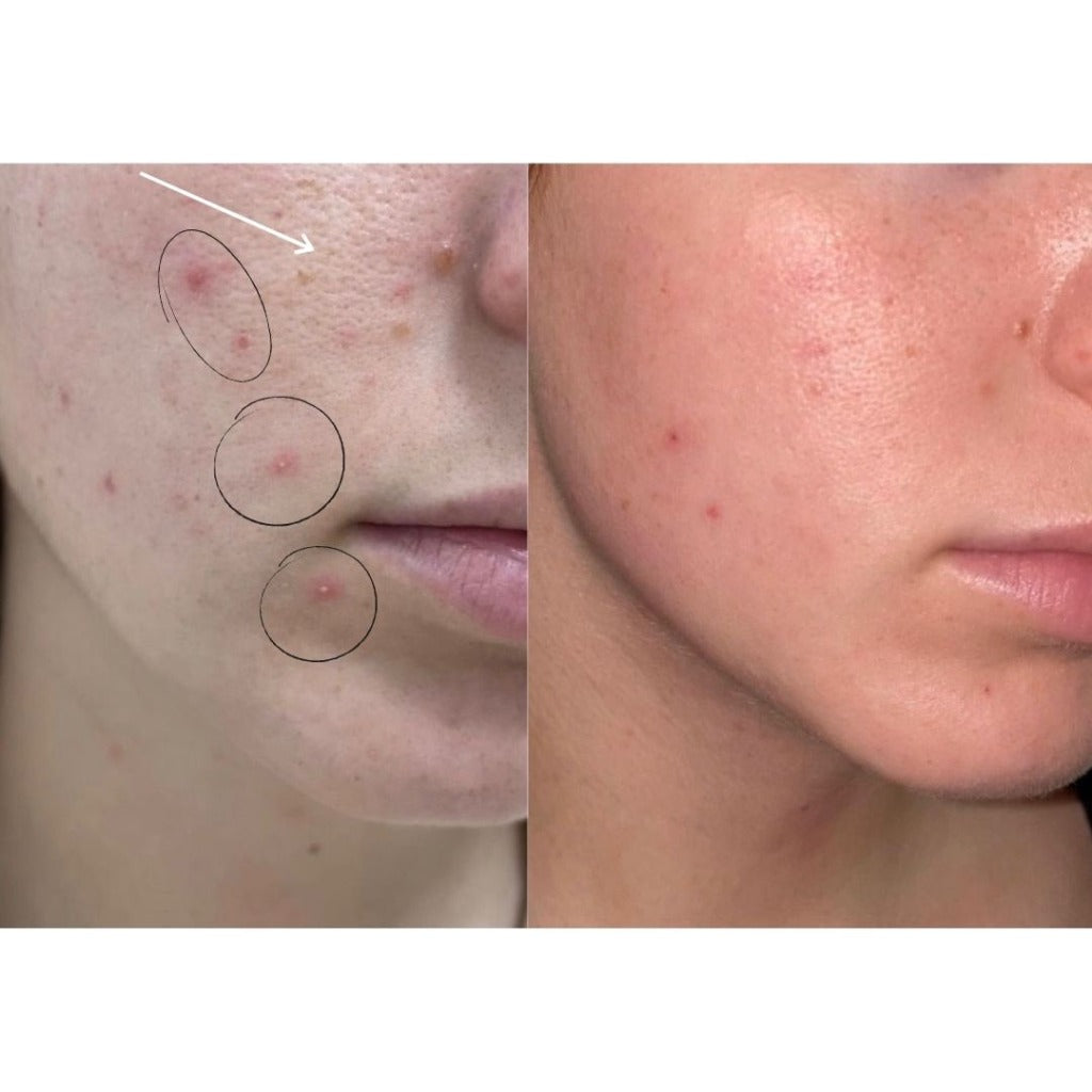 Serum Facial anti-imperfecciones Clear de Dafna Skincare 30 ml